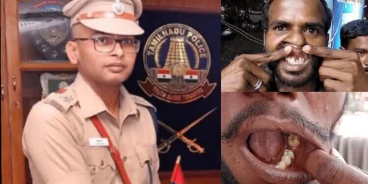 IPS Suspend: For the first time in custody, an IPS broke the teeth of the accused… read what happened next