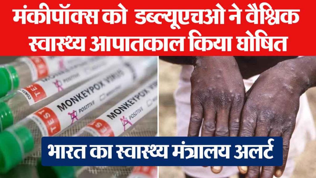 Monkeypox: No monkeypox or corona…; People of India are afraid of 'this' disease, big revelation in survey!