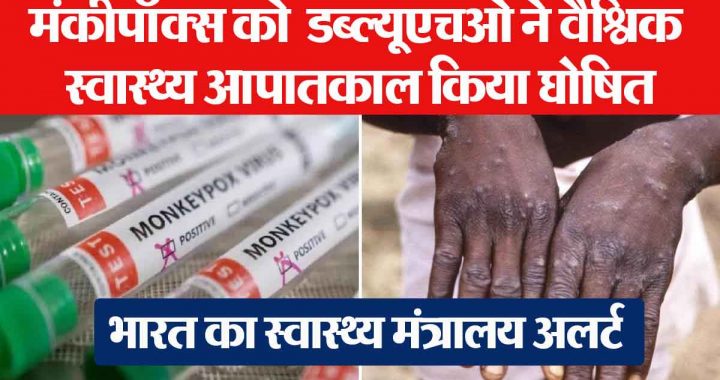 Monkeypox: No monkeypox or corona…; People of India are afraid of 'this' disease, big revelation in survey!