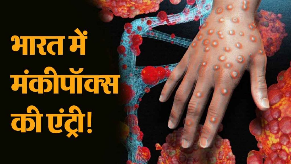 Monkeypox Virus: Entry of monkeypox in India! How many people have died so far? Know how dangerous it is