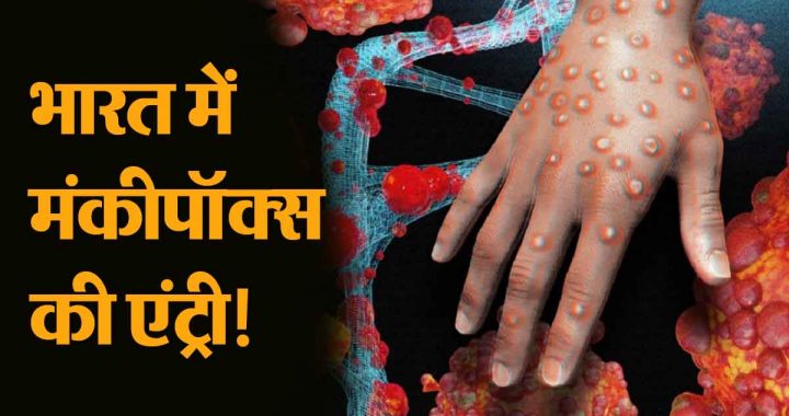 Monkeypox Virus: Entry of monkeypox in India! How many people have died so far? Know how dangerous it is