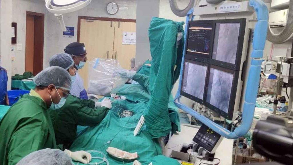 ACI once again created new history, laser cut angioplasty done in Cathlab was broadcasted live across the country