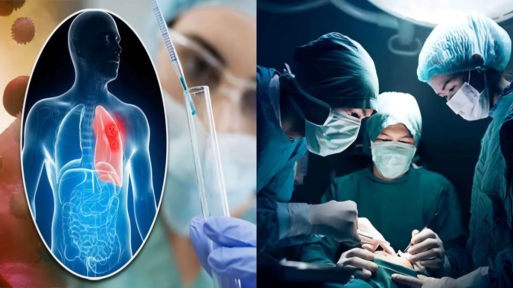 Affordable Cancer Treatment
