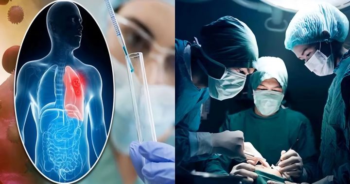 Affordable Cancer Treatment