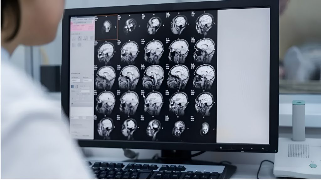 Covid Brain Ageing