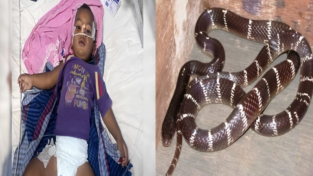 Snake Bite Survival