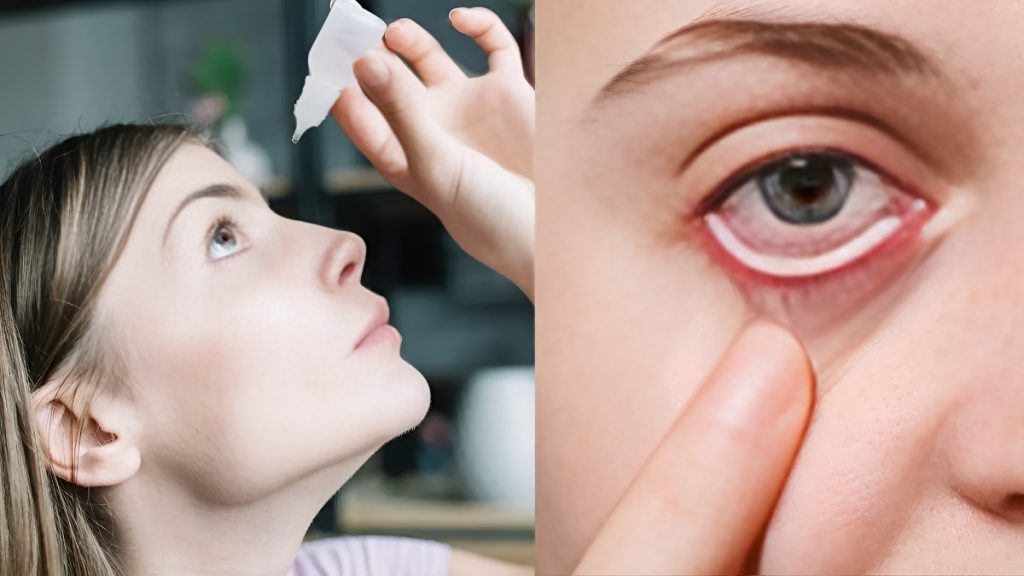 Monsoon Eye Care