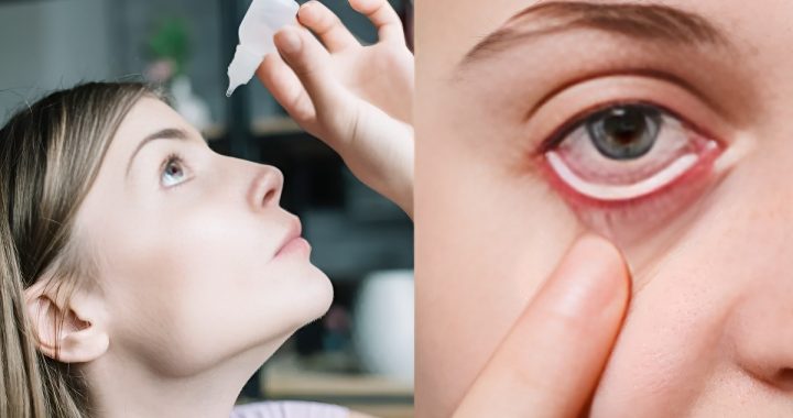 Monsoon Eye Care