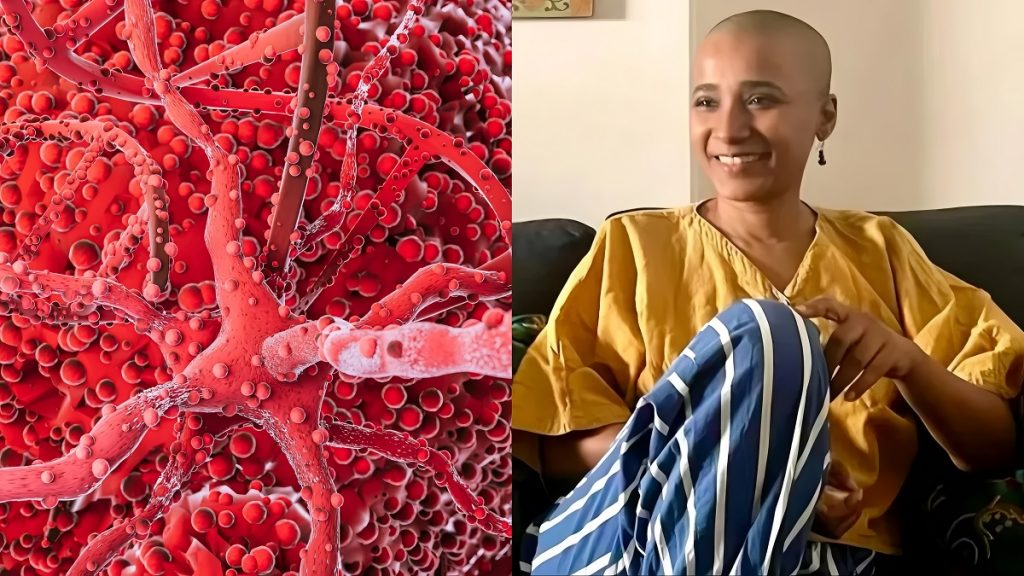 Tannishtha Chatterjee Cancer