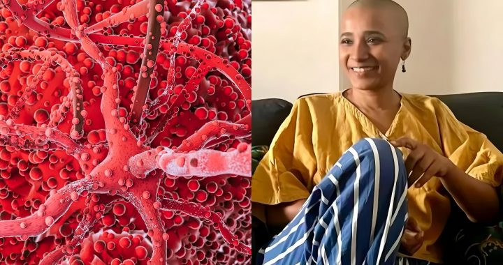Tannishtha Chatterjee Cancer