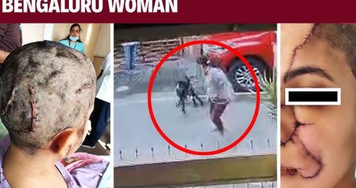 If you can't handle it, why keep it? Dog attacked woman; she needed 50 stitches.