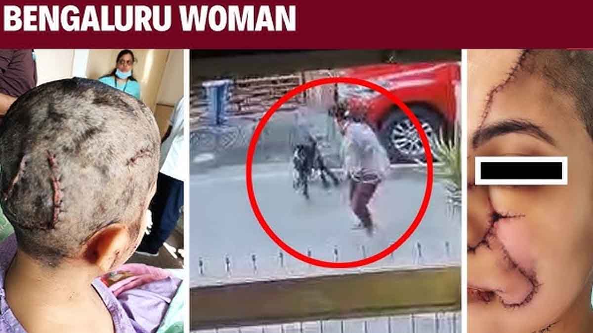 If you can't handle it, why keep it? Dog attacked woman; she needed 50 stitches.