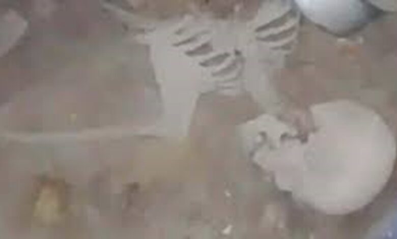 Raipur Skeleton Case