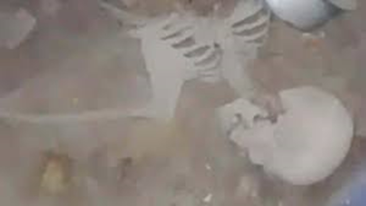 Raipur Skeleton Case