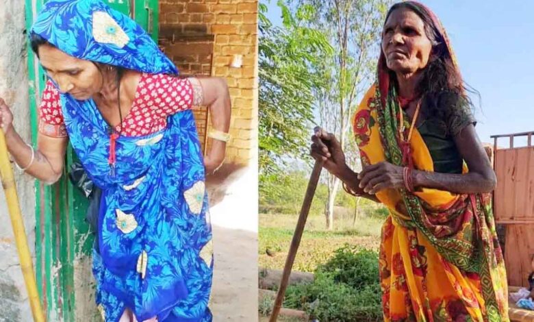 Youth turns into old age: People in 15 villages are drinking poison, fluoride causing tooth decay and crooked bones
