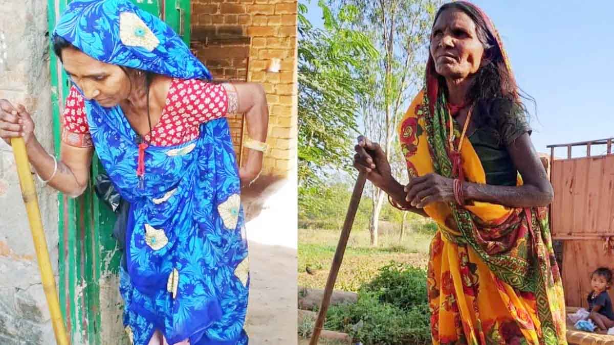 Youth turns into old age: People in 15 villages are drinking poison, fluoride causing tooth decay and crooked bones