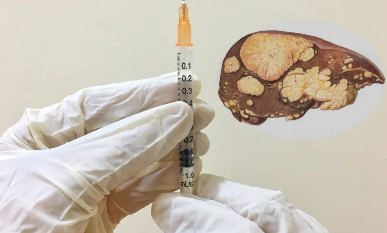 Hepatitis B
