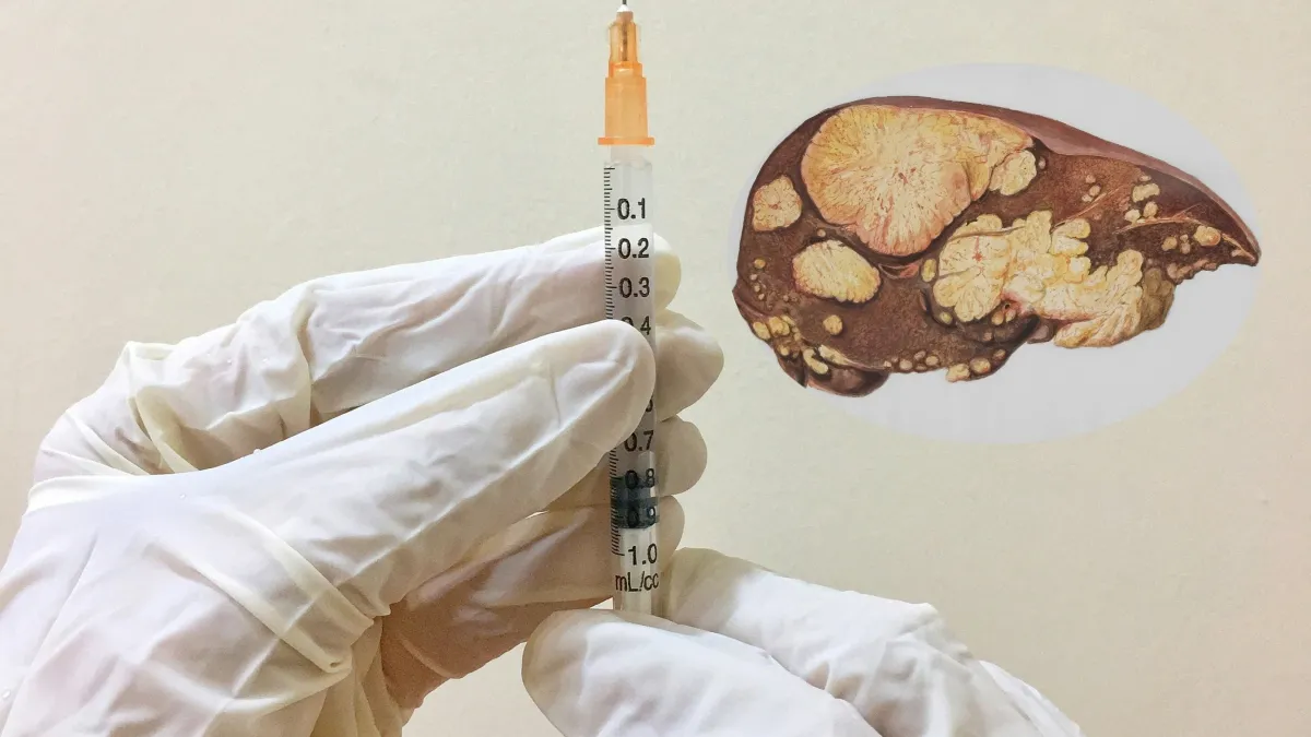 Hepatitis B